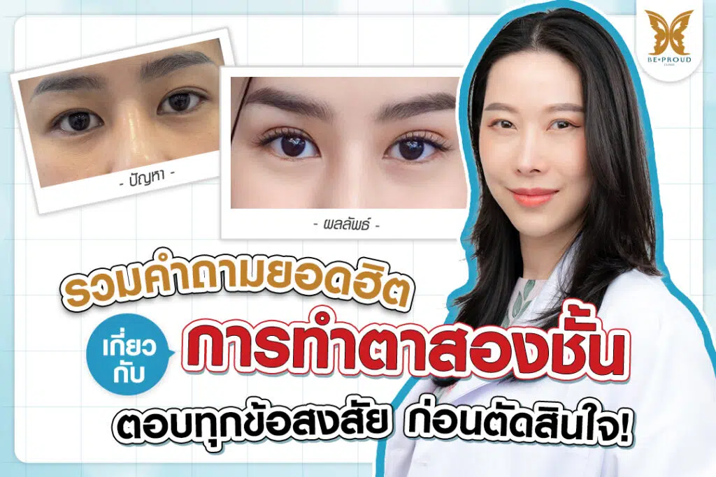ตาสองชั้น ศัลยกรรมตาสองชั้น เทคนิคทำตาสองชั้น รีวิวทำตาสองชั้น