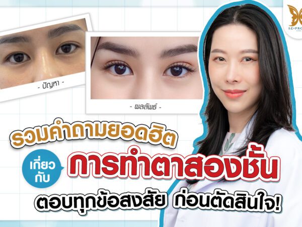 ตาสองชั้น ศัลยกรรมตาสองชั้น เทคนิคทำตาสองชั้น รีวิวทำตาสองชั้น
