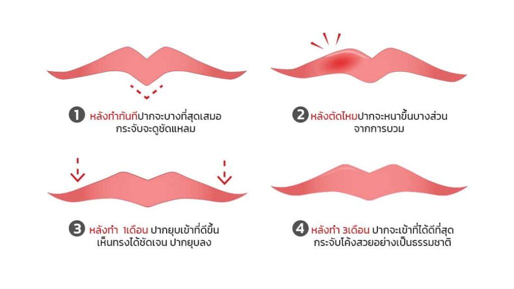 ระยะการคลายตัวของปากกระจับ