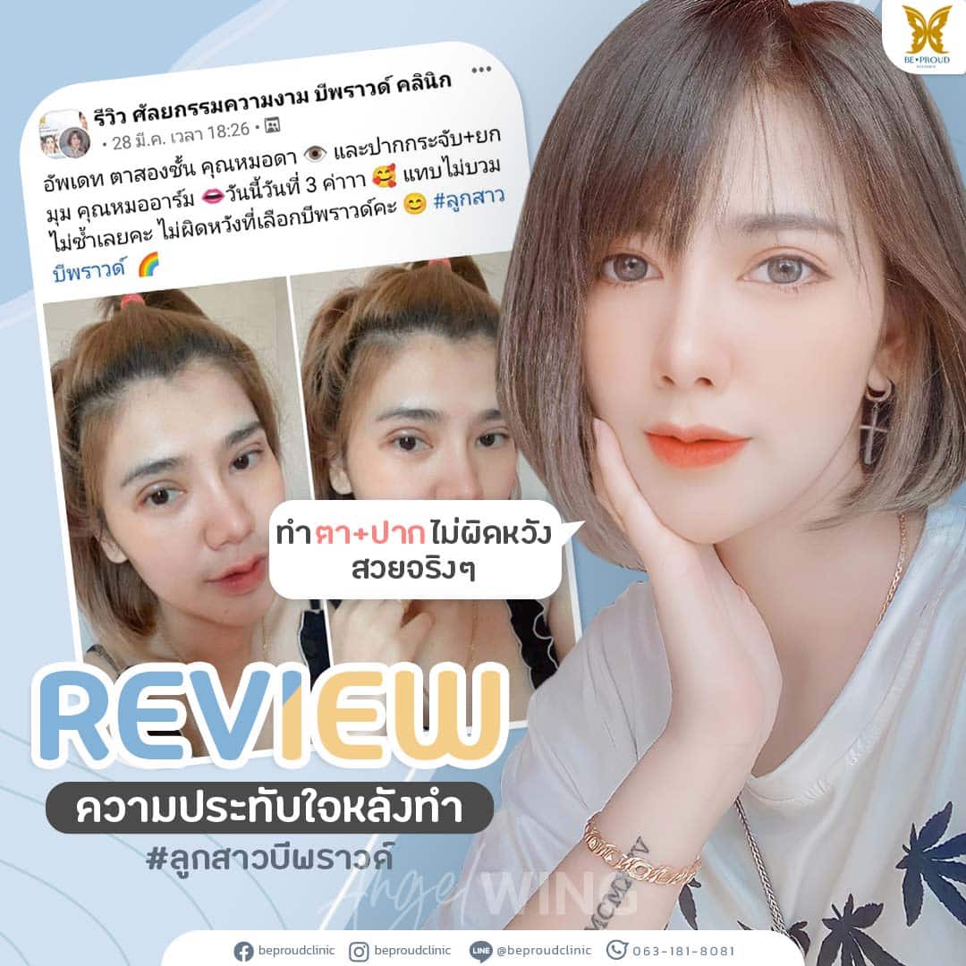 ศัลยกรรมตาสองชั้น ปากกระจับปีกนางฟ้า