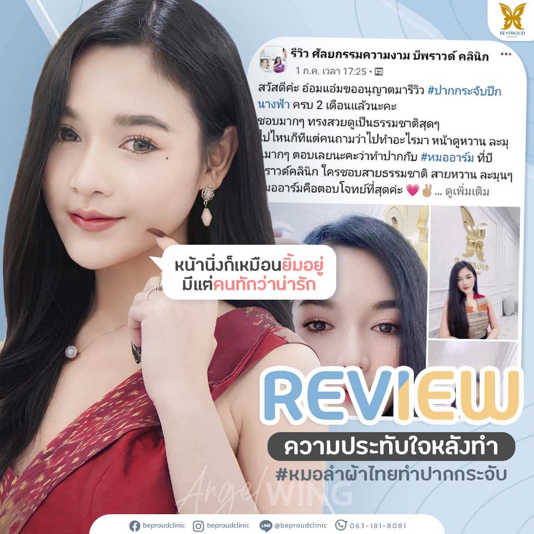 ศัลยกรรม ปากกระจับปีกนางฟ้า