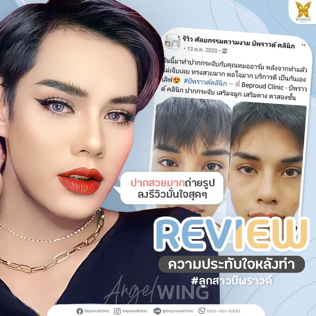 ศัลยกรรม ปากกระจับปีกนางฟ้า