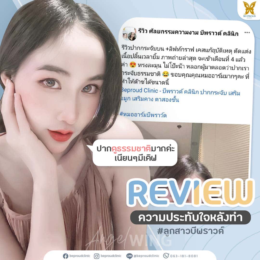 ศัลยกรรม ปากกระจับปีกนางฟ้า