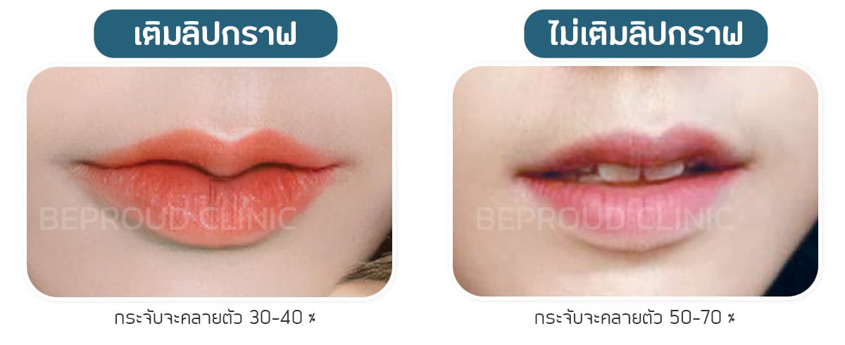 เติมลิปกราฟ ไม่เติมลิปกราฟ