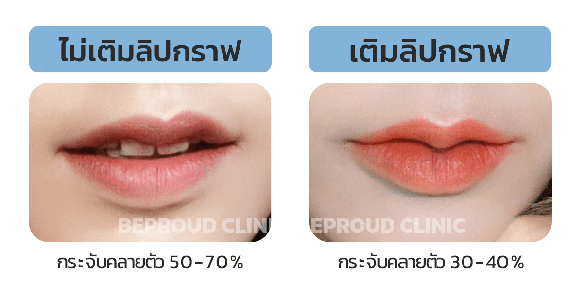 ไม่เติมลิฟกราฟ เติมลิฟกราฟ