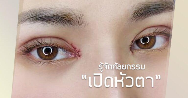 ศัลยกรรม เปิดหัวตา