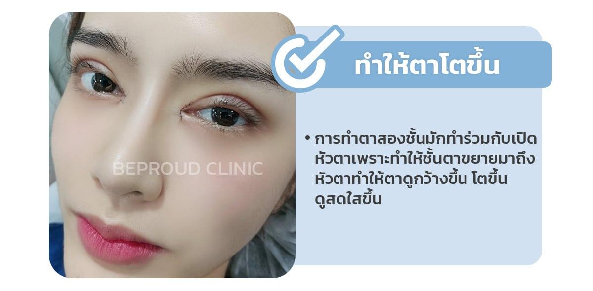 การเปิดหัวตา ชั้นตาดูโตขึ้นมั้ย