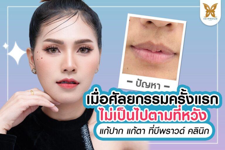 ศัลยกรรมครั้งแรกไม่เป็นตามที่หวัง