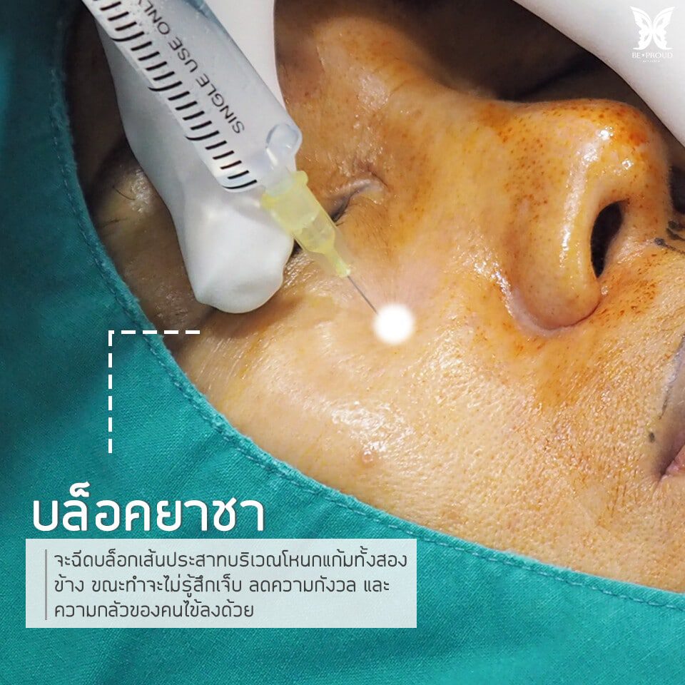 มีการบล็อกยาชา เพื่อให้ขณะทำไม่รู้สึกเจ็บและลดความกังวล