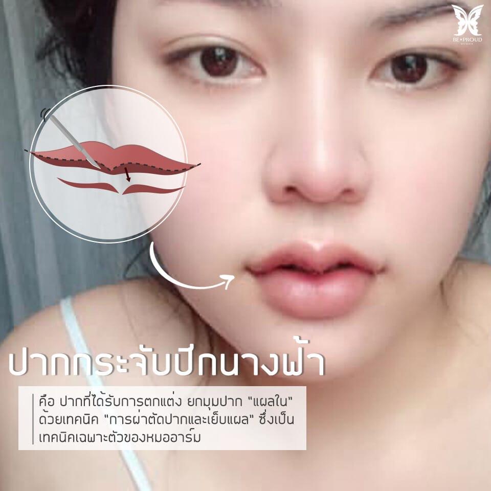 ปากกระจับปีกนางฟ้า