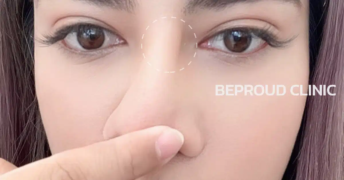 เคสซิลิโคนลอย