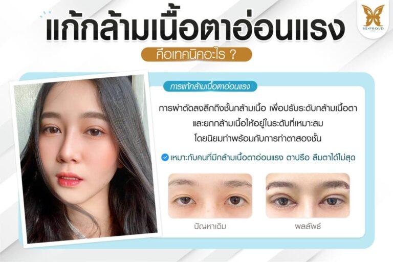 แก้กล้ามเนื้อตาอ่อนแรง