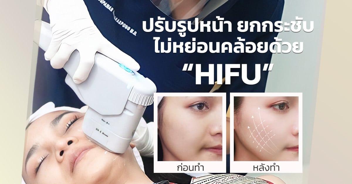 ยกกระชับผิว ด้วย Ultra Lift