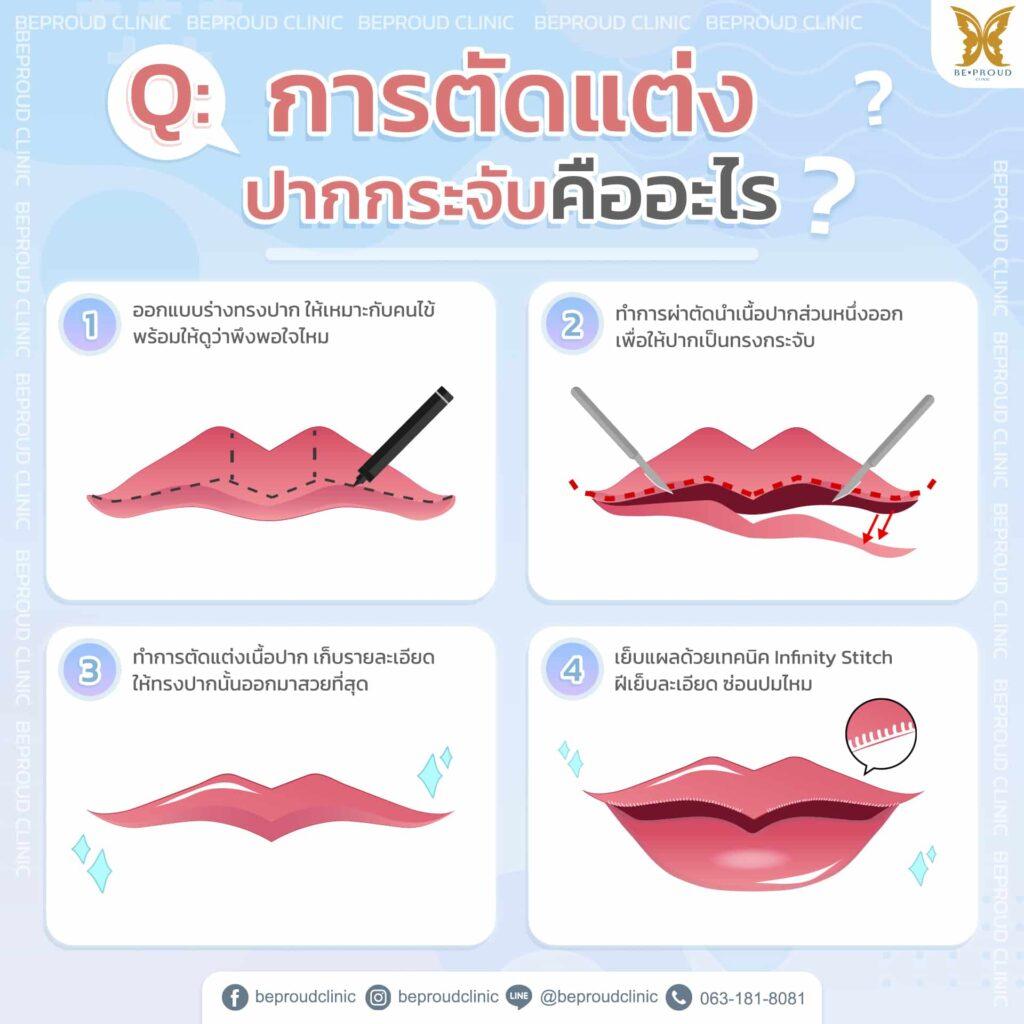 ปากกระจับ ยกมุมปาก