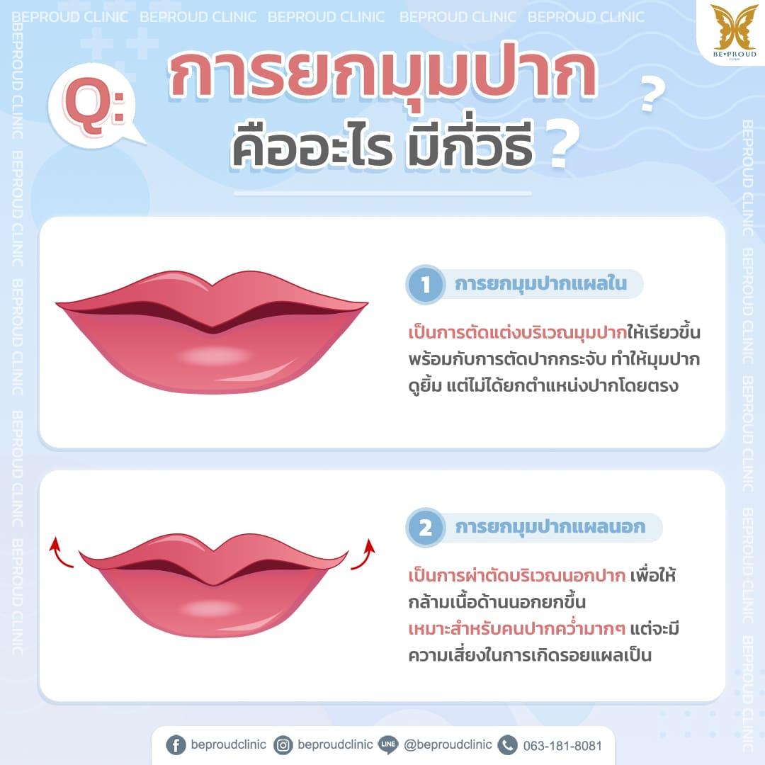 ปากกระจับ ยกมุมปาก