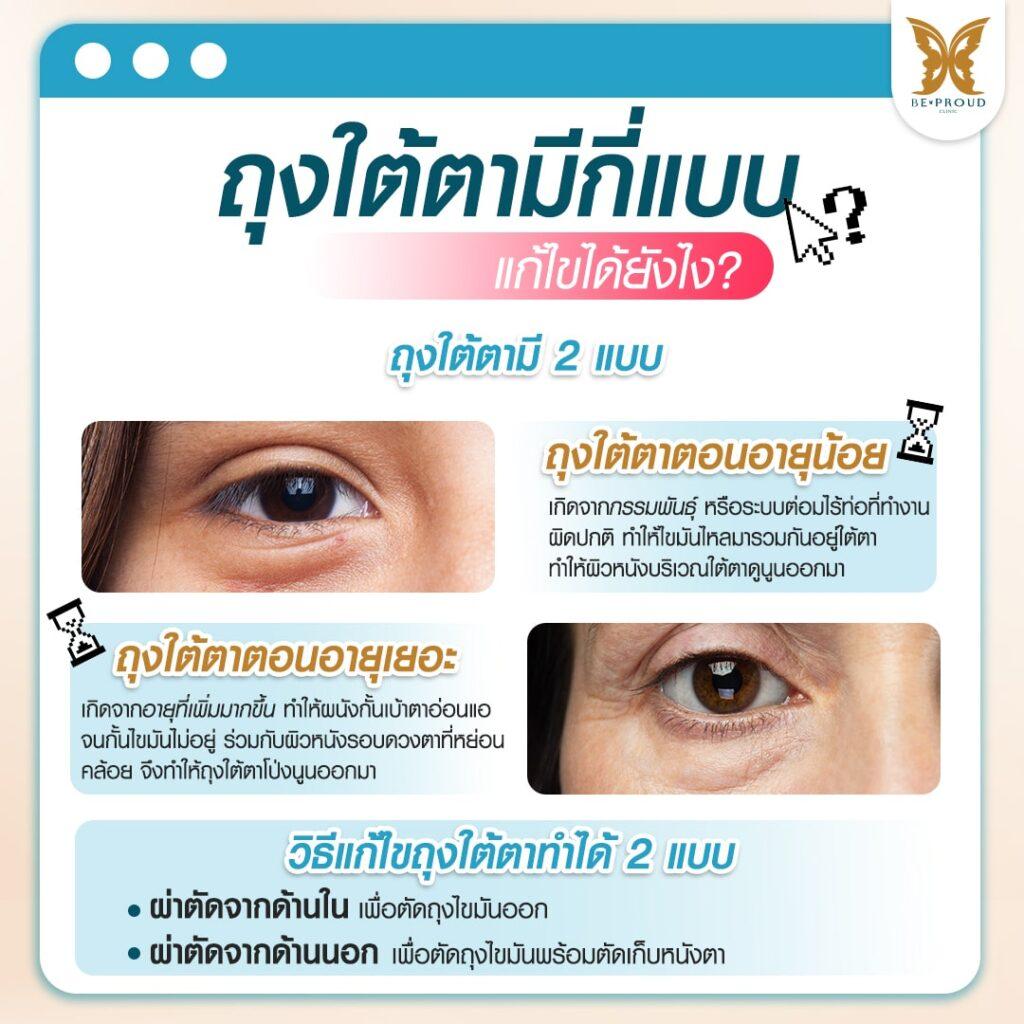 ตัดถุงใต้ตาตอนอายุน้อย ตัดถุงใต้ตาตอนอายุเยอะ