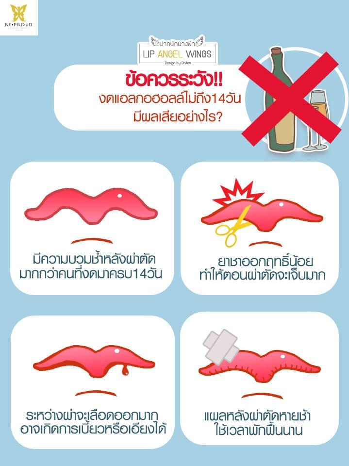 งดแอลกอฮอลล์ ก่อนทำศัลยกรรม