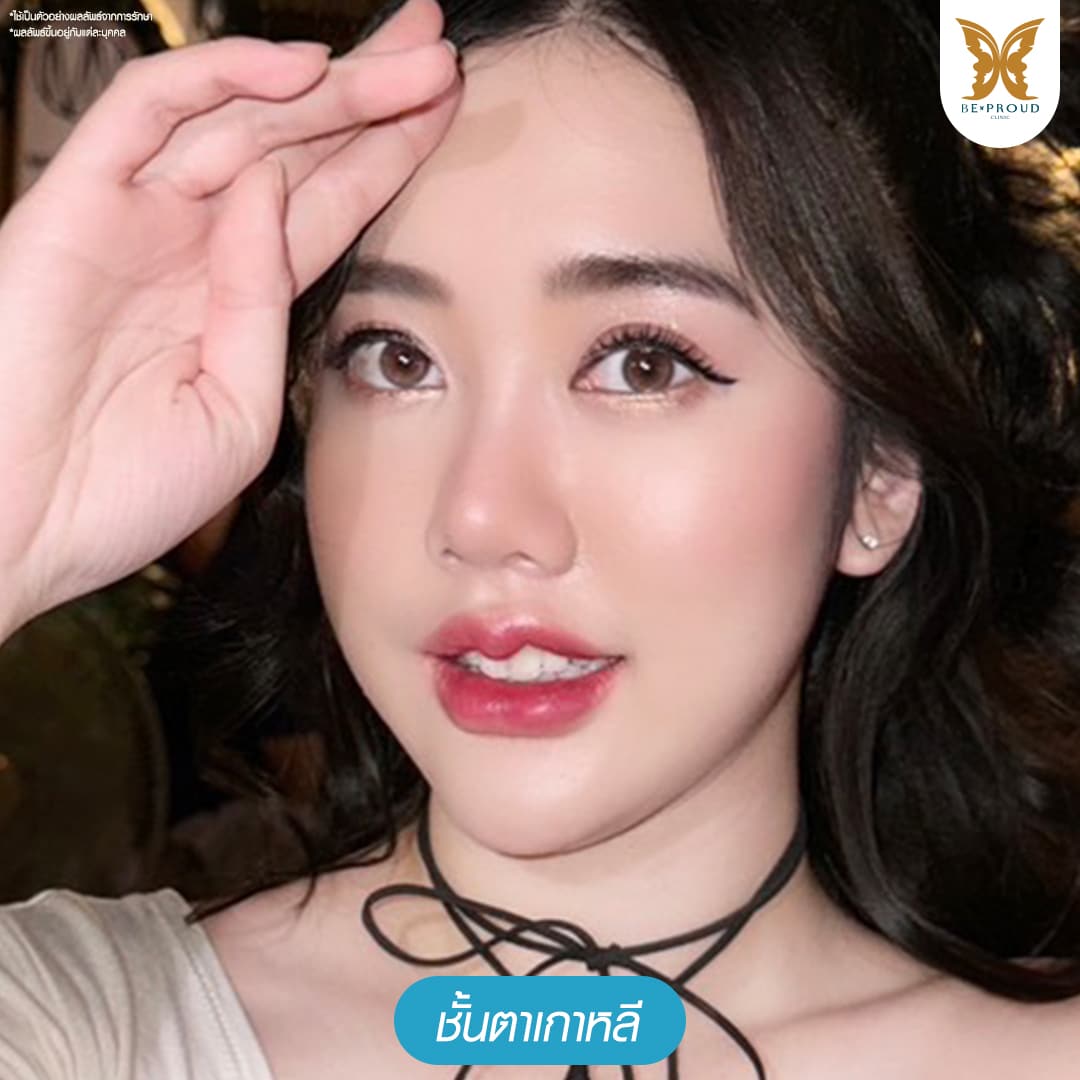 ตาสองชั้นเกาหลี บีพราวด์