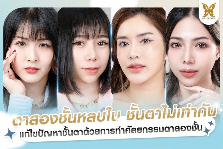 ตาสองชั้นหลบใน ชั้นตาไม่เท่ากัน