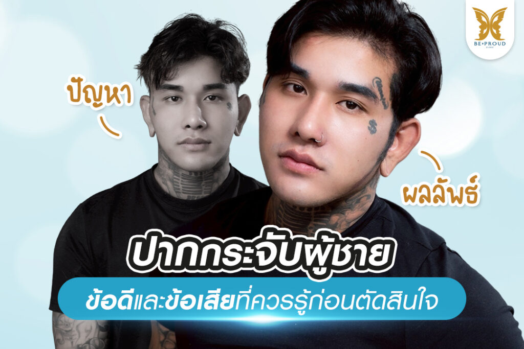 ปากกระจับผู้ชาย ทรงปากผู้ชาย ปากกระจับผู้ชาย ทําที่ไหนดี