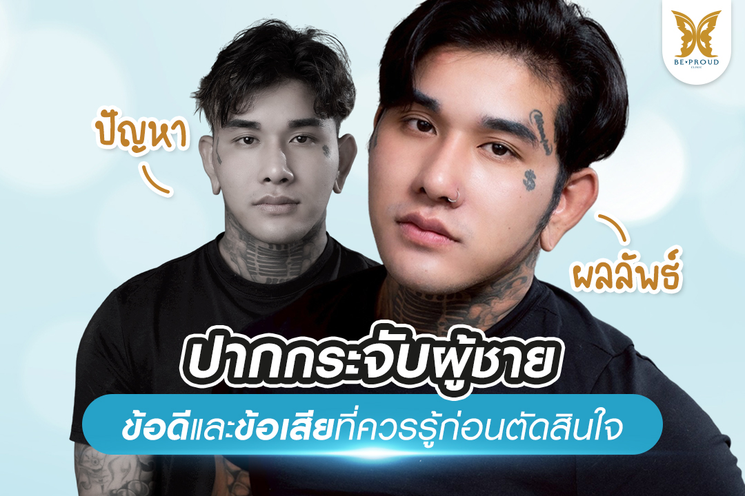 ปากกระจับผู้ชาย ทรงปากผู้ชาย ปากกระจับผู้ชาย ทําที่ไหนดี