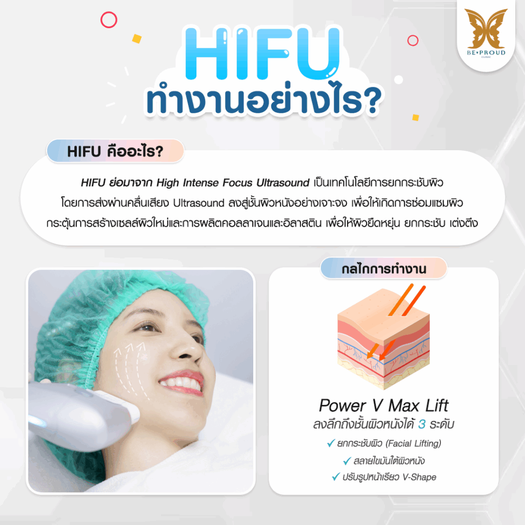 หัตถการปรับรูปหน้า​ HIFU