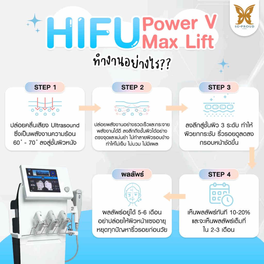 หัตถการปรับรูปหน้า HIFU