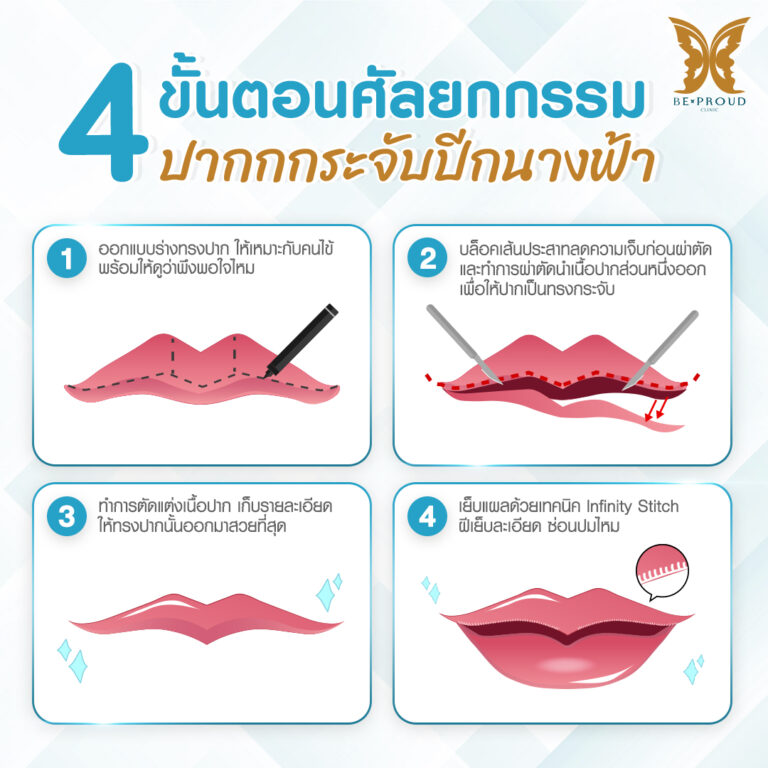 ปากกระจับผู้ชาย ทรงปากผู้ชาย ปากกระจับผู้ชาย ทําที่ไหนดี