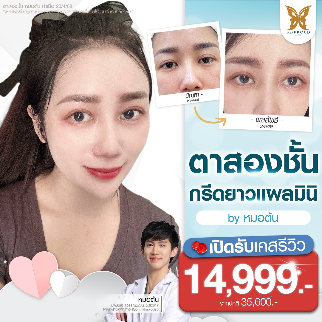 หมอต้น บีพราวด์คลินิก