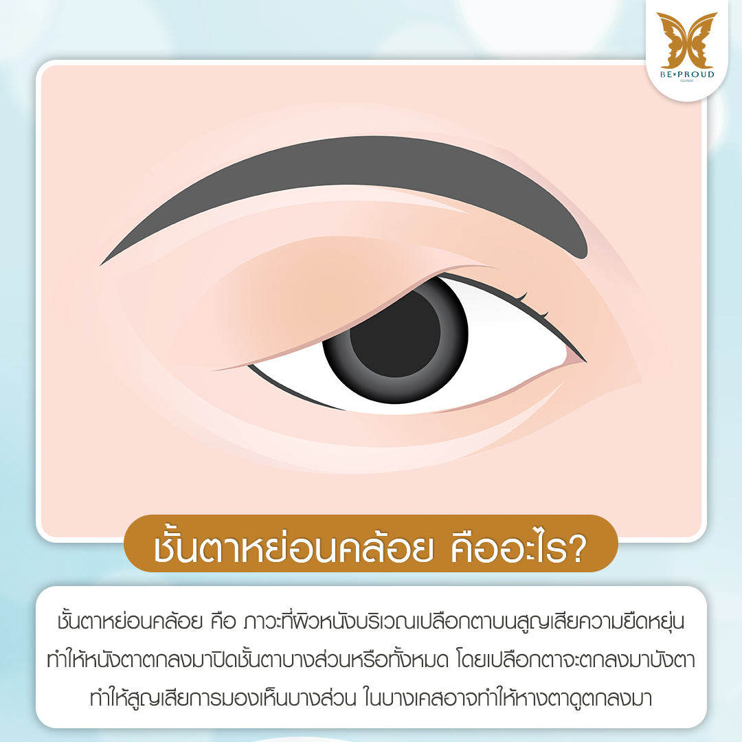 ชั้นตาหย่อนคล้อย , หนังตาตก , การผ่าตัดแก้ไขชั้นตา , การมองเห็น