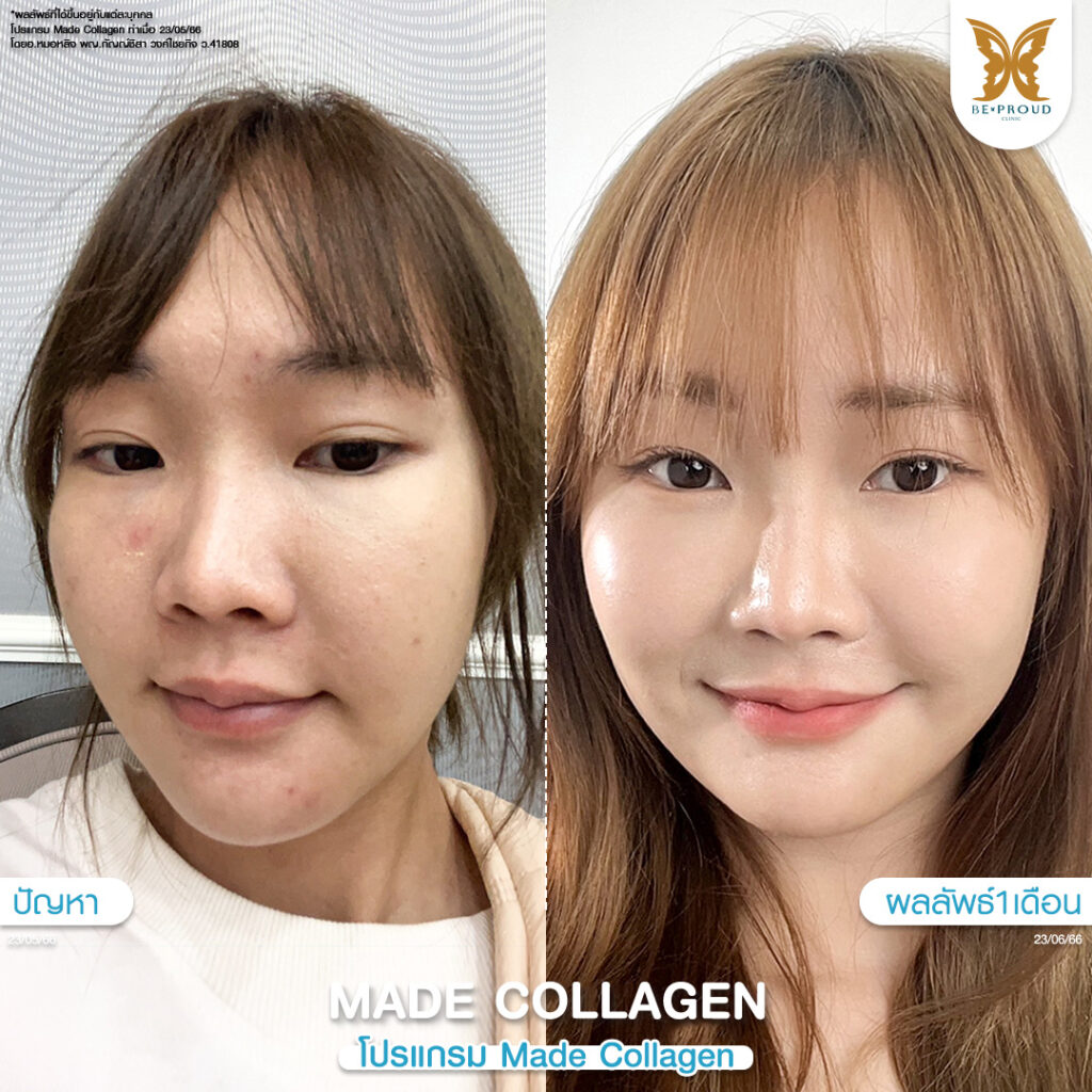 โปรแกรมวิตามินผิว Made Collagen