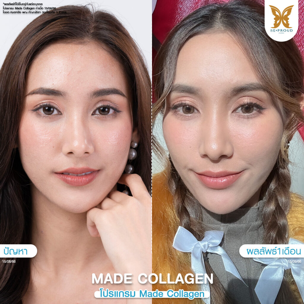 โปรแกรมวิตามินผิว Made Collagen