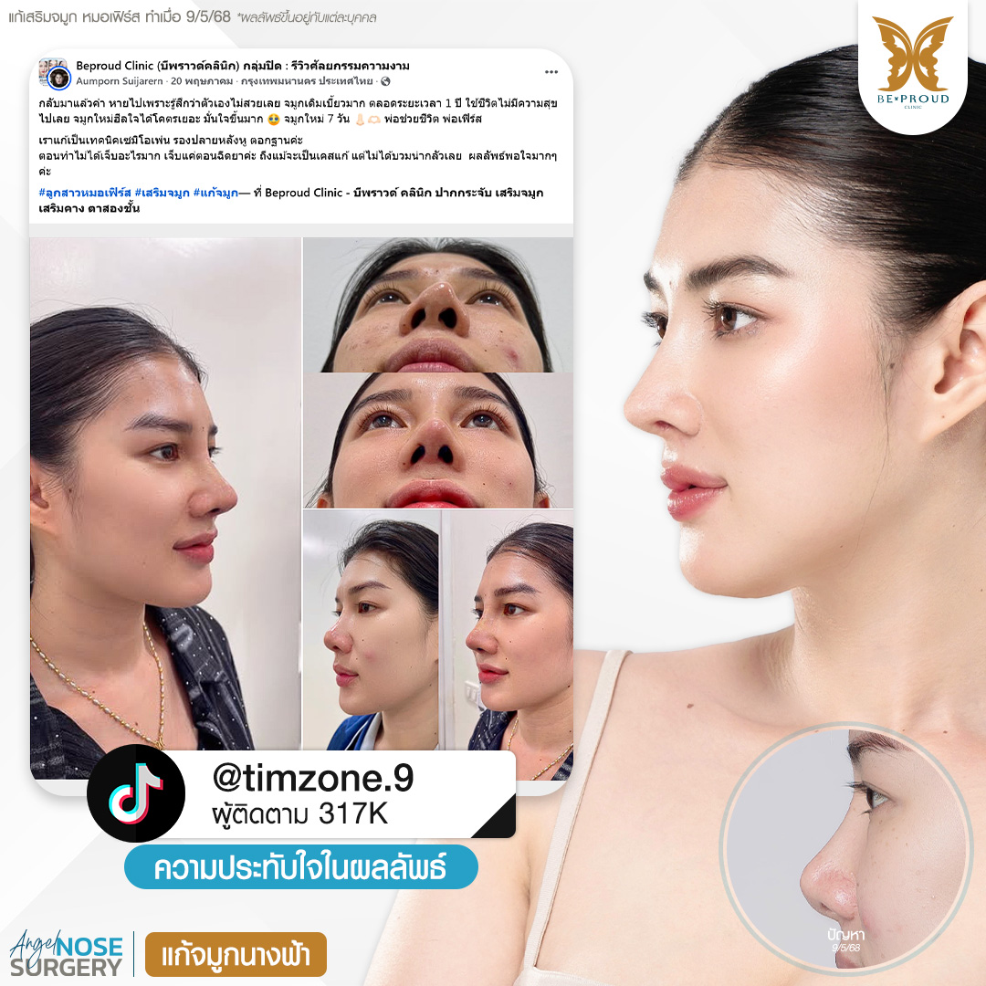 หมอเฟิร์ส บีพราวด์