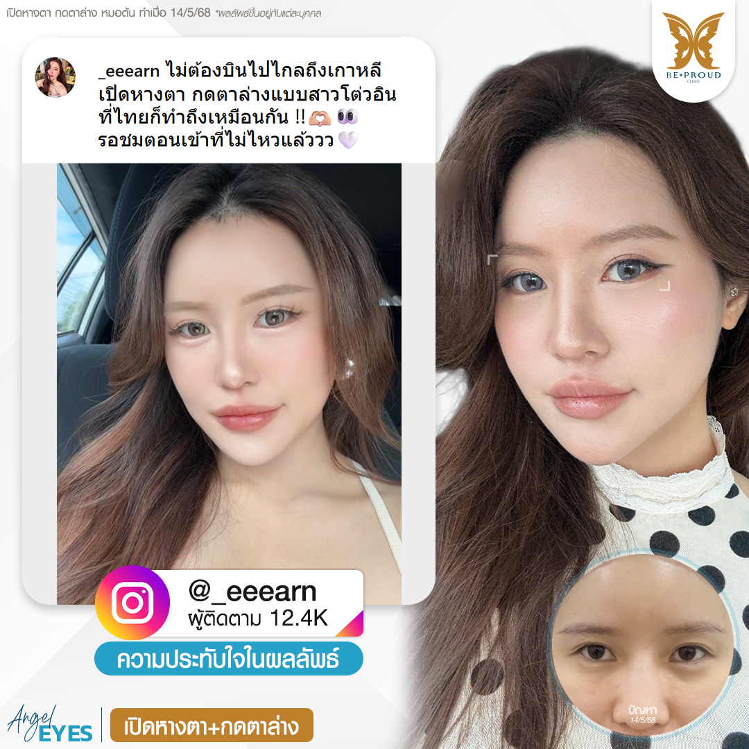 หมอต้น บีพราวด์คลินิก