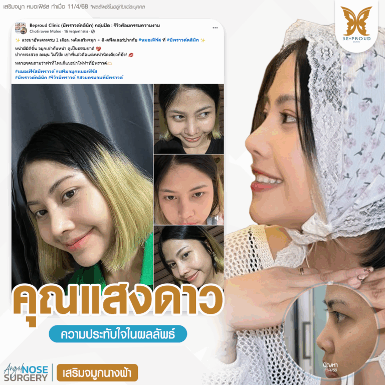หมอเฟิร์ส บีพราวด์