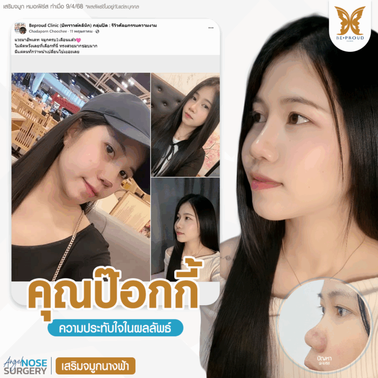 หมอเฟิร์ส บีพราวด์