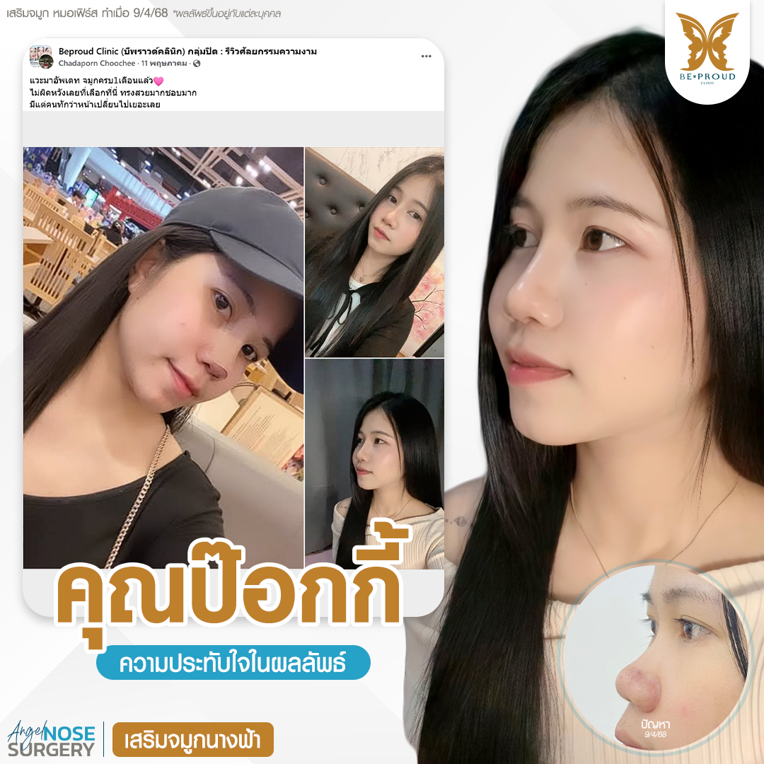 หมอเฟิร์ส บีพราวด์