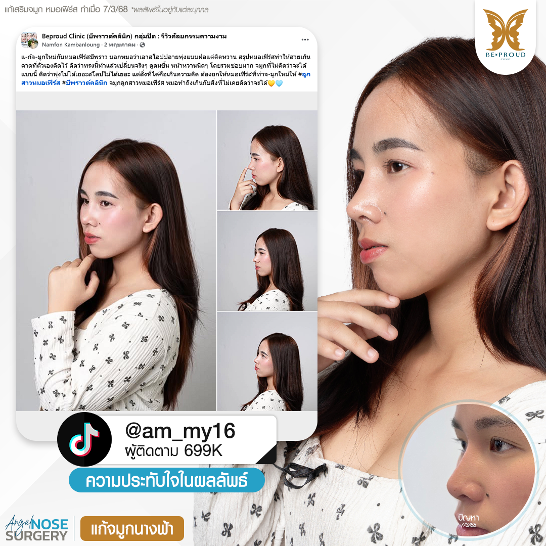 หมอเฟิร์ส บีพราวด์