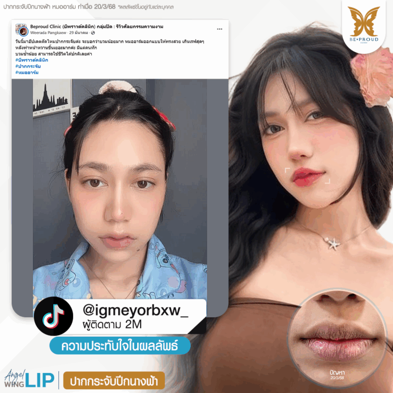 Dr.Arm หมออาร์ม บีพราวด์