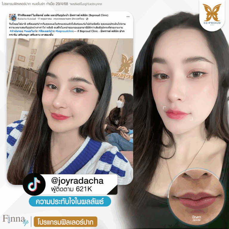 หมอไบร์ท บีพราวด์