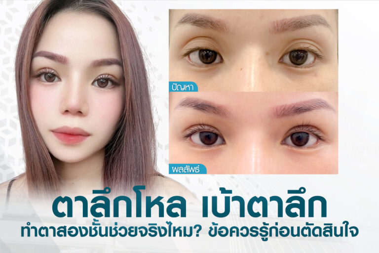 ภาพศัลยแพทย์ผู้เชี่ยวชาญที่บีพราวด์คลินิกกำลังประเมินและให้คำปรึกษาแก่คนไข้ที่มีปัญหาเบ้าตาลึก ตาลึกโหล เพื่อวางแผนการทำตาสองชั้นและเติมไขมันเบ้าตา