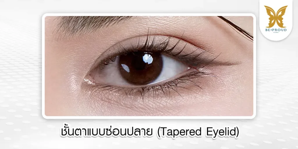 ตาสองชั้น ดาราเกาหลี ตาสองชั้น ดาราเกาหลี: เทรนด์ตาสวยหวานเป็นธรรมชาติ ทำที่ไหนดี?