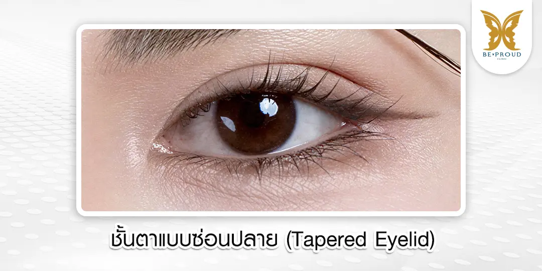 ภาพตัวอย่างลักษณะชั้นตาแบบซ่อนปลาย (Tapered Eyelid) สไตล์เกาหลี หัวตาแคบและค่อยๆ กว้างขึ้นช่วงหางตา ให้ลุคหวานละมุน เป็นธรรมชาติ จากบีพราวด์คลินิก