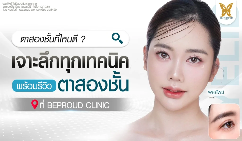 ตาสองชั้นที่ไหนดี เจาะลึกทุกเทคนิคพร้อมรีวิวทำตาสองชั้นที่ Beproud Clinic