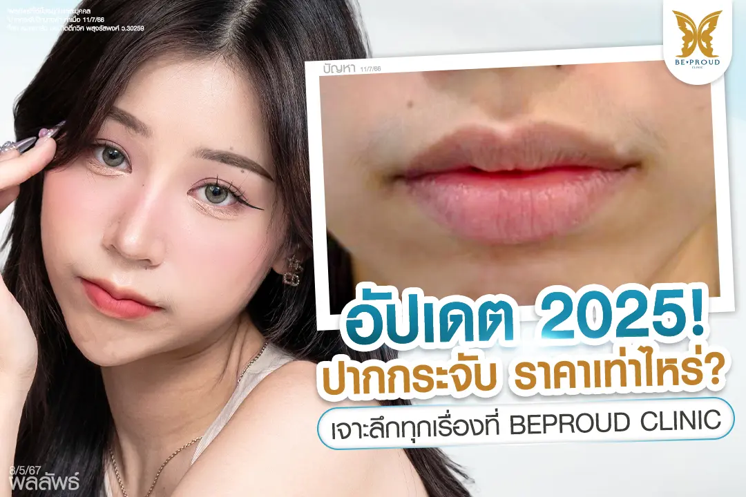 ศัลยกรรมปากกระจับปีกนางฟ้าที่ BEPROUD Clinic แสดงริมฝีปากที่ดูเรียวสวยอวบอิ่มเป็นทรงกระจับสวยหวานเป็นธรรมชาติ