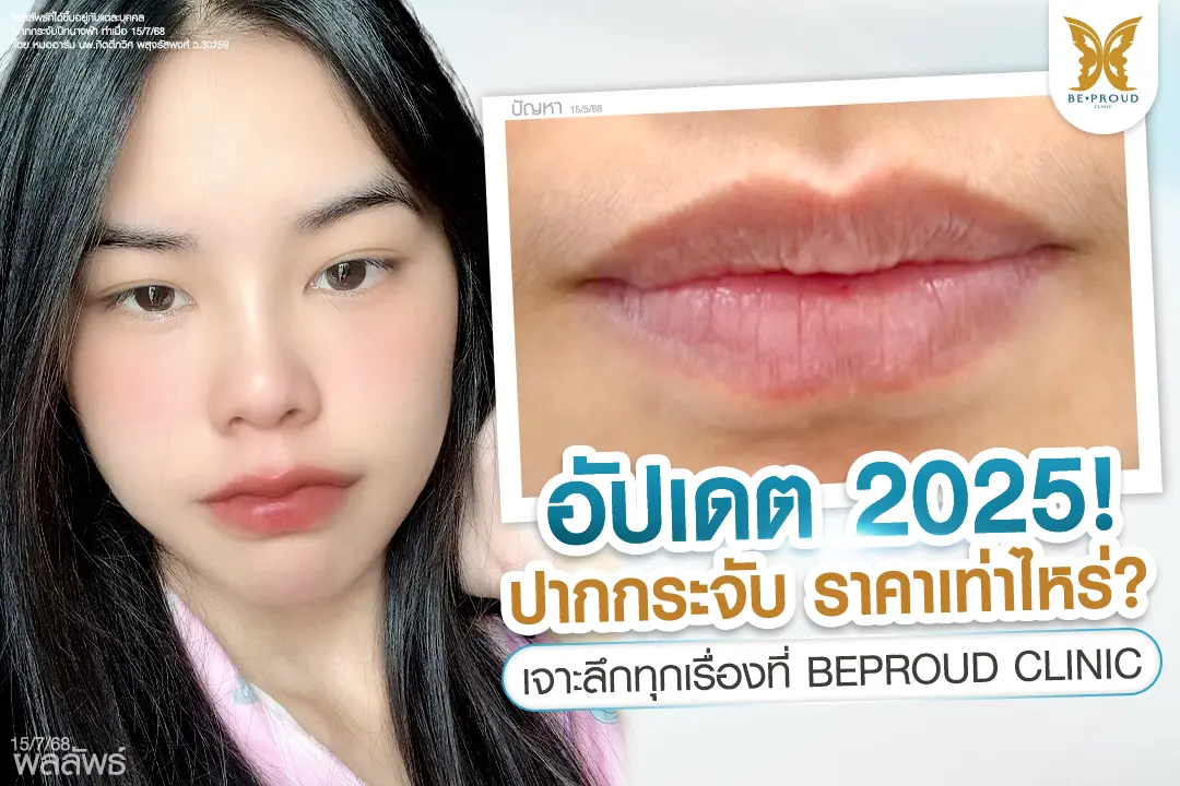 ปากกระจับ ราคา อัปเดต 2025! ปากกระจับ ราคาเท่าไหร่? เจาะลึกทุกเรื่องที่ BEPROUD Clinic