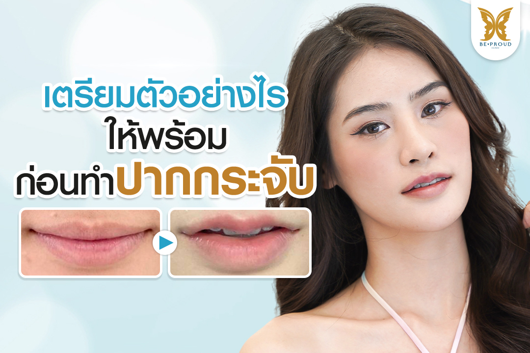 ภาพอินโฟกราฟิกจากบีพราวด์คลินิก ให้ความรู้ในหัวข้อ "เตรียมตัวอย่างไรให้พร้อมก่อนทำปากกระจับ" พร้อมภาพรีวิวเปรียบเทียบก่อนทำและหลังทำศัลยกรรม