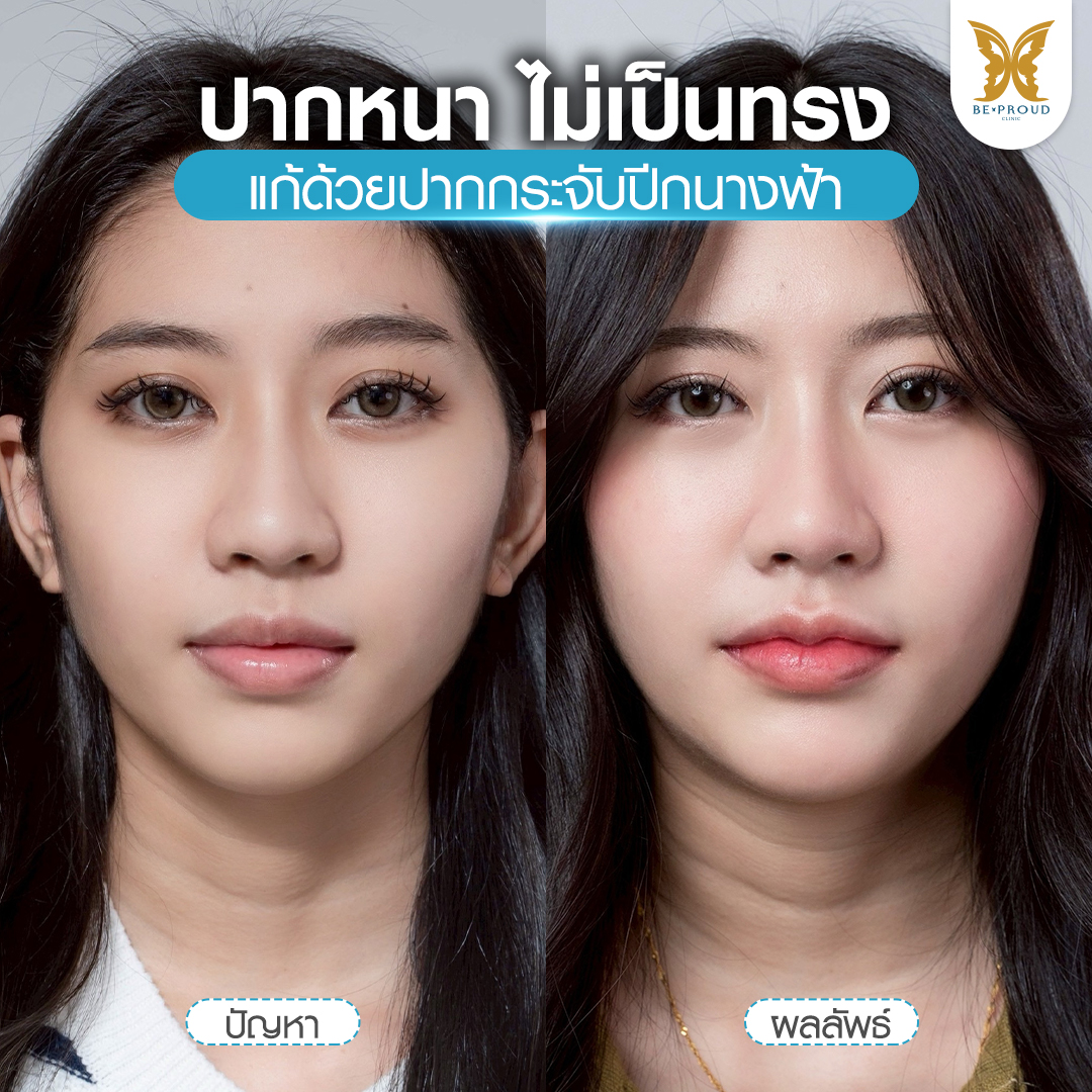 ทำความรู้จัก "ปากกระจับ" เทรนด์ความงามที่มาแรงที่สุดในยุคนี้! ทำความรู้จัก "ปากกระจับ" เทรนด์ความงามที่มาแรงที่สุดในยุคนี้!