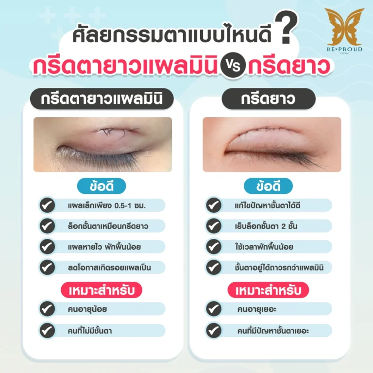 ศัลยกรรมตาแบบไหนดี เปรียบเทียบกรีดตายาวแผลมินิ VS กรีดยาว Beproud Clinic