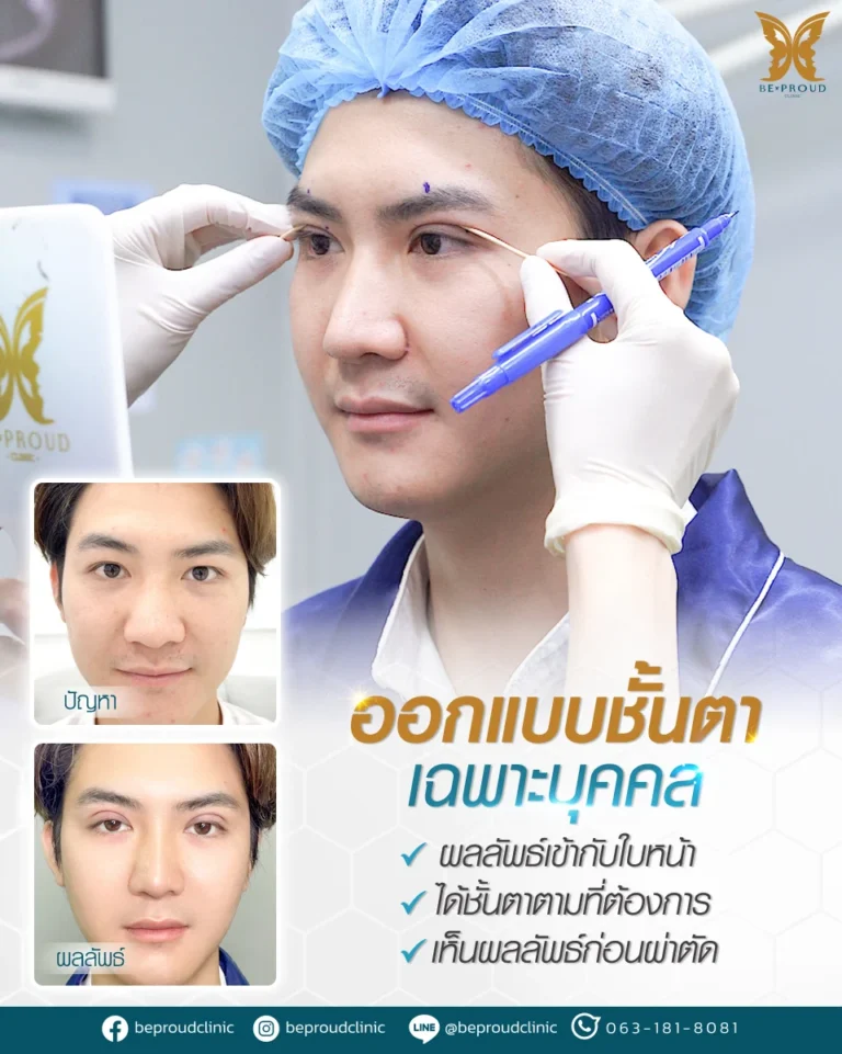 เปรียบเทียบ 2 เทคนิคทำตาสองชั้นที่บีพราวด์ คลินิก เทคนิคกรีดยาว VS กรีดยาวแผลมินิ